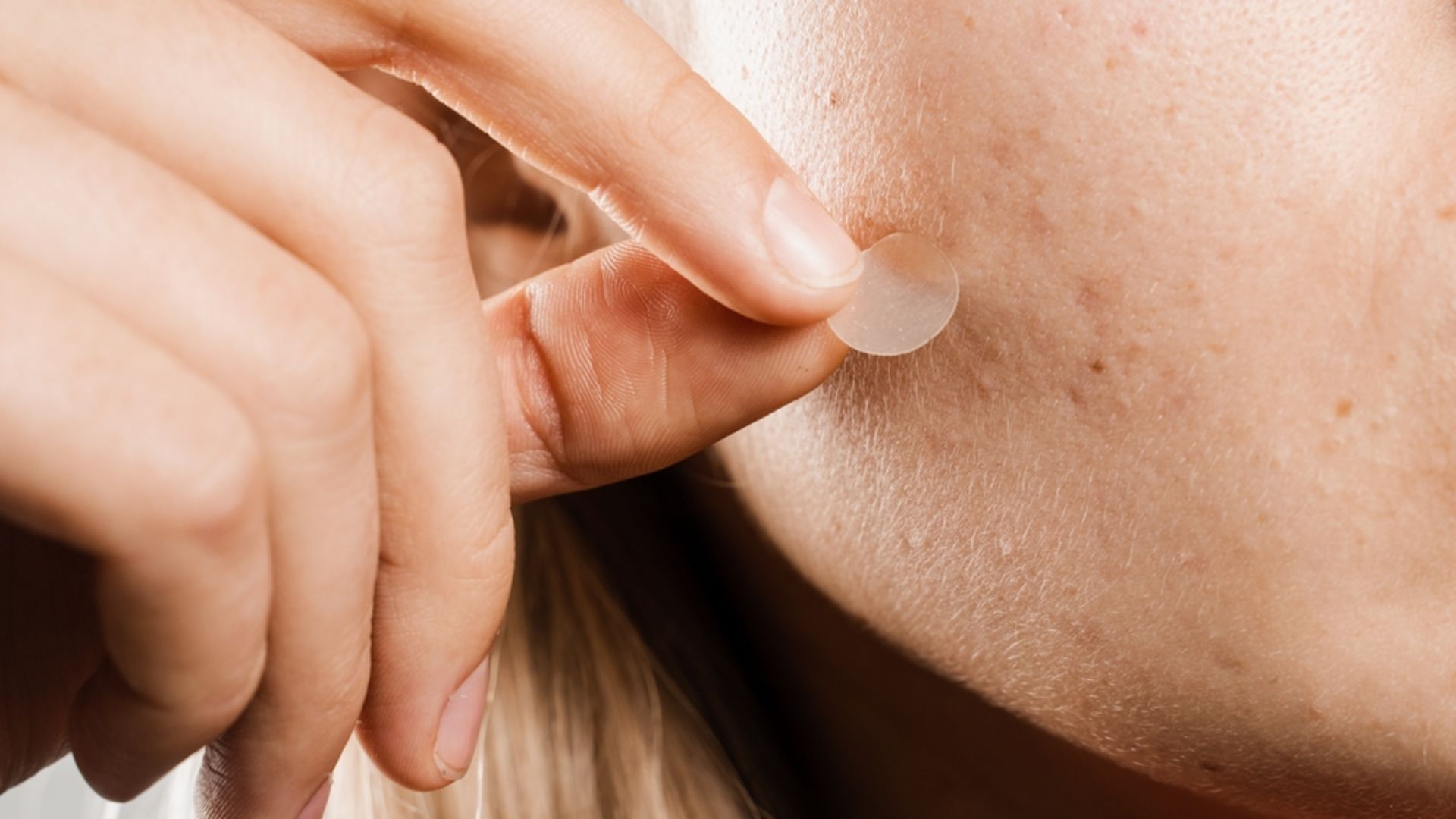 Sivilce bantları işe yarıyor mu?